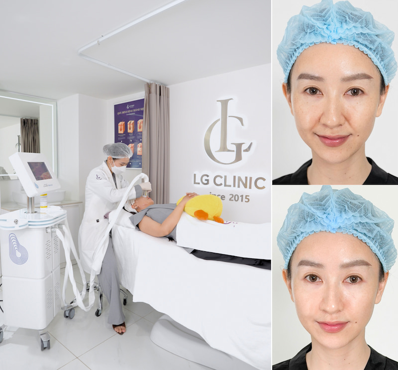 kết quả sau điều trị