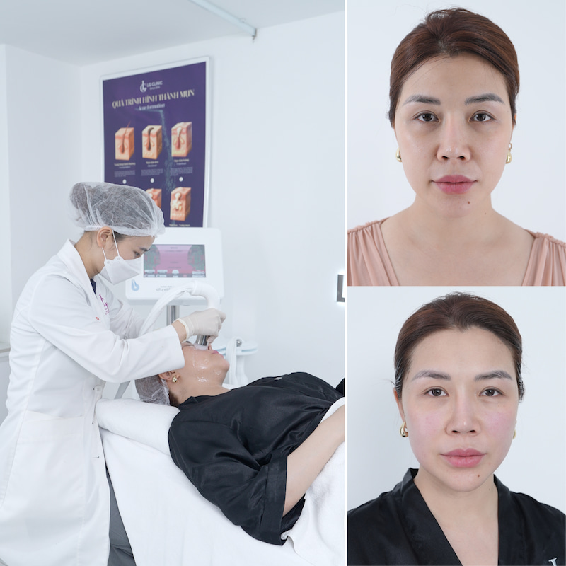 kết quả sau điều trị