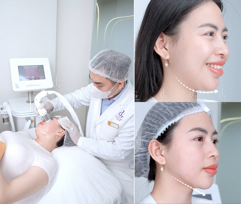 kết quả sau điều trị